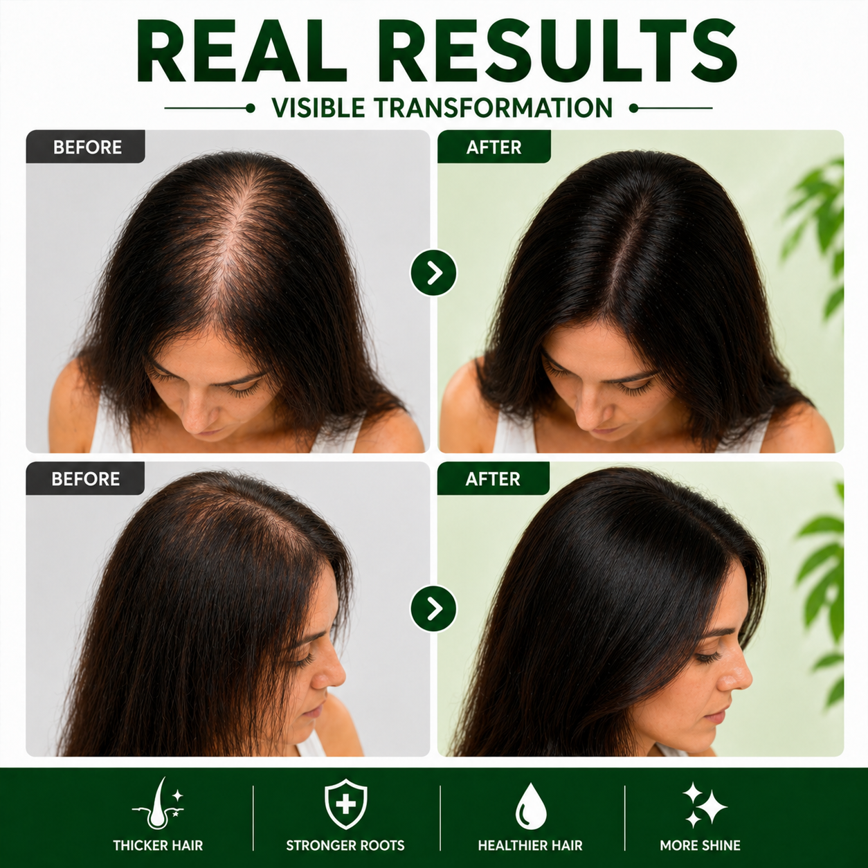 Kachita Spell Strong Hair Growth Collection Kit Shampoo, Hair Mask & Serum with Biotin, Onion, Rosemary, Ginger, Cinnamon & Bay Leaf Hair Care